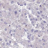 Anti-SNAP91 antibody produced in rabbit 