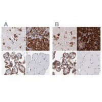 Anti-SND1 antibody produced in rabbit HPA002632-100UL