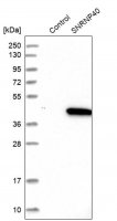 Anti-SNRNP40 antibody produced in rabbit HPA027345-100UL