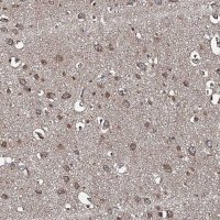 Anti-SNX32 antibody produced in rabbit 