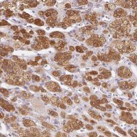 Anti-SOAT1 antibody produced in rabbit