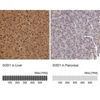 Anti-SOD1 antibody produced in rabbit