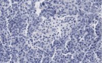Anti-Somatostatin-28 Antibody, clone 2B19 ZooMAb� Rabbit Monoclonal 