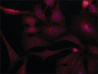 Anti-SORBS2 (N-terminal) antibody produced in rabbit 