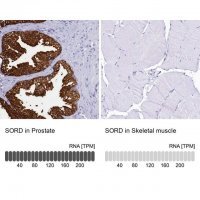 Anti-SORD antibody produced in rabbit HPA040260-100UL