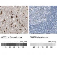 Anti-SORT1 antibody produced in rabbit 