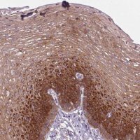 Anti-SOWAHC antibody produced in rabbit