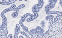 Anti-SOX17 Antibody, clone 3F7, ZooMAb� Rabbit Monoclonal 