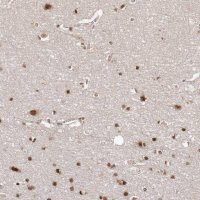 Anti-SOX4 antibody produced in rabbit 