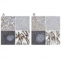 Anti-SP100 antibody produced in rabbit 