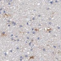Anti-SPATA20 antibody produced in rabbit 