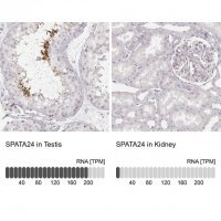 Anti-SPATA24 antibody produced in rabbit 