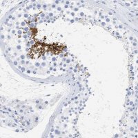 Anti-SPATA3 antibody produced in rabbit