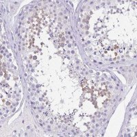 Anti-SPATA4 antibody produced in rabbit