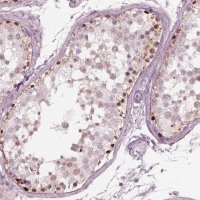 Anti-SPATA6L antibody produced in rabbit