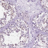 Anti-SPDYA antibody produced in rabbit 