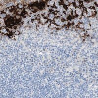 Anti-SPINK5 antibody produced in rabbit
