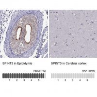 Anti-SPINT3 