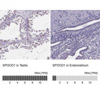 Anti-SPOCD1 antibody produced in rabbit
