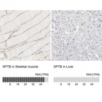 Anti-SPTB antibody produced in rabbit 