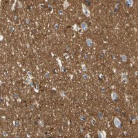 Anti-SPTBN1 antibody produced in rabbit