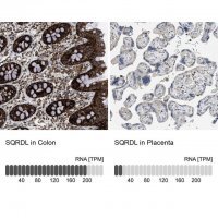 Anti-SQRDL antibody produced in rabbit 