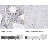Anti-SREK1 antibody produced in rabbit HPA037674-100UL