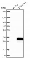 Anti-SREK1IP1 antibody produced in rabbit HPA045677-100UL