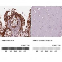 Anti-SRI antibody produced in rabbit 