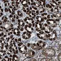 Anti-SRM antibody produced in rabbit HPA015746-100UL