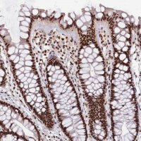 Anti-SRRT antibody produced in rabbit