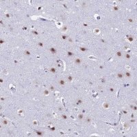 Anti-SRSF5 antibody produced in rabbit