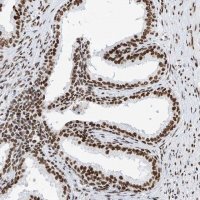 Anti-SRSF6 antibody produced in rabbit HPA029005-100UL