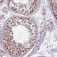 Anti-SRSF9 antibody produced in rabbit 