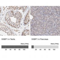 Anti-SSBP1 antibody produced in rabbit 