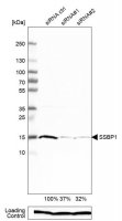 Anti-SSBP1 antibody produced in rabbit 