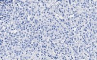 Anti-SSNA1 Antibody, clone 4C4 ZooMAb® Rabbit Monoclonal