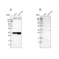 Anti-SSR1 antibody produced in rabbit 