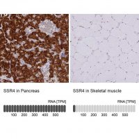 Anti-SSR4 antibody produced in rabbit HPA045209-100UL