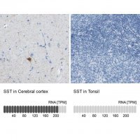 Anti-SST antibody produced in rabbit