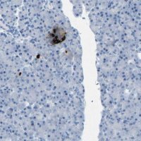 Anti-SST antibody produced in rabbit