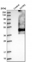 Anti-SSTR2 antibody produced in rabbit 