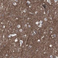 Anti-SSTR2 antibody produced in rabbit 