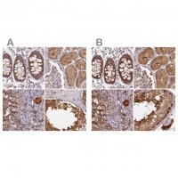 Anti-ST13 antibody produced in rabbit HPA046412-100UL