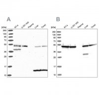 Anti-ST13 antibody produced in rabbit HPA046412-100UL