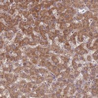 Anti-ST3GAL3 antibody produced in rabbit