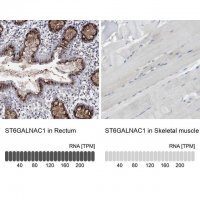 Anti-ST6GALNAC1 antibody produced in rabbit 