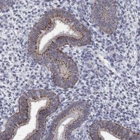 Anti-ST6GALNAC1 antibody produced in rabbit 