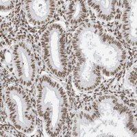 Anti-STAG1 antibody produced in rabbit 
