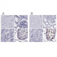 Anti-STAG3 antibody produced in rabbit